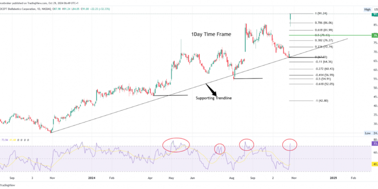 Top Stock Gainers & Losers: PRCT Stock +32%, PHG -16% Drop